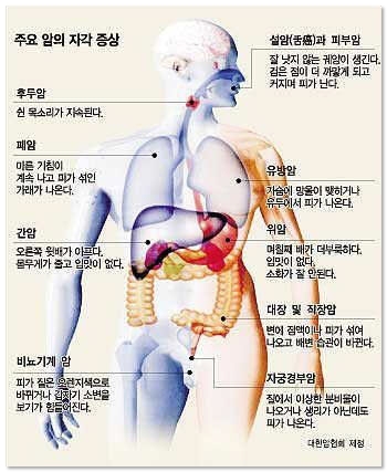 주요 암의 자각 증상