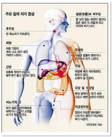 주요 암의 자각 증상