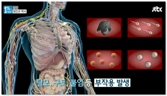 탈모, 구토, 불임 등 부작용 발생